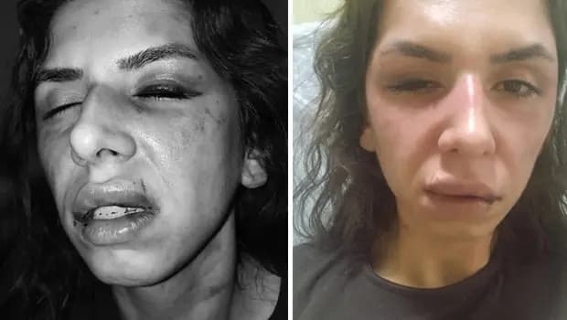 Eşini darbeden koca tutuklandı