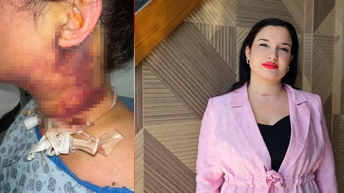Estetik uğruna canından oluyordu! 2 gün süren ölüm kalım savaşı: "Yaşam mücadelem oldu"